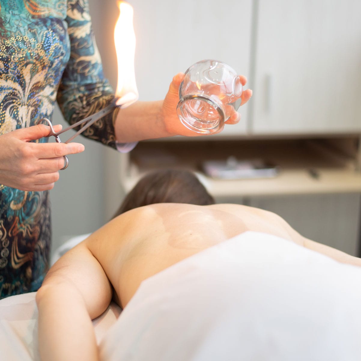 Fire Cupping